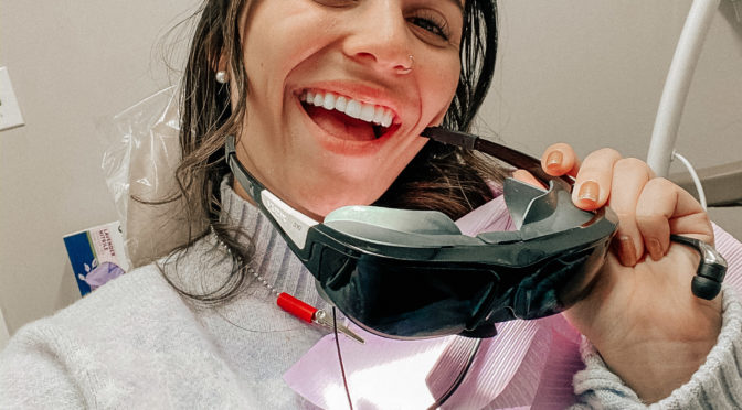 what you need to know about invisalign