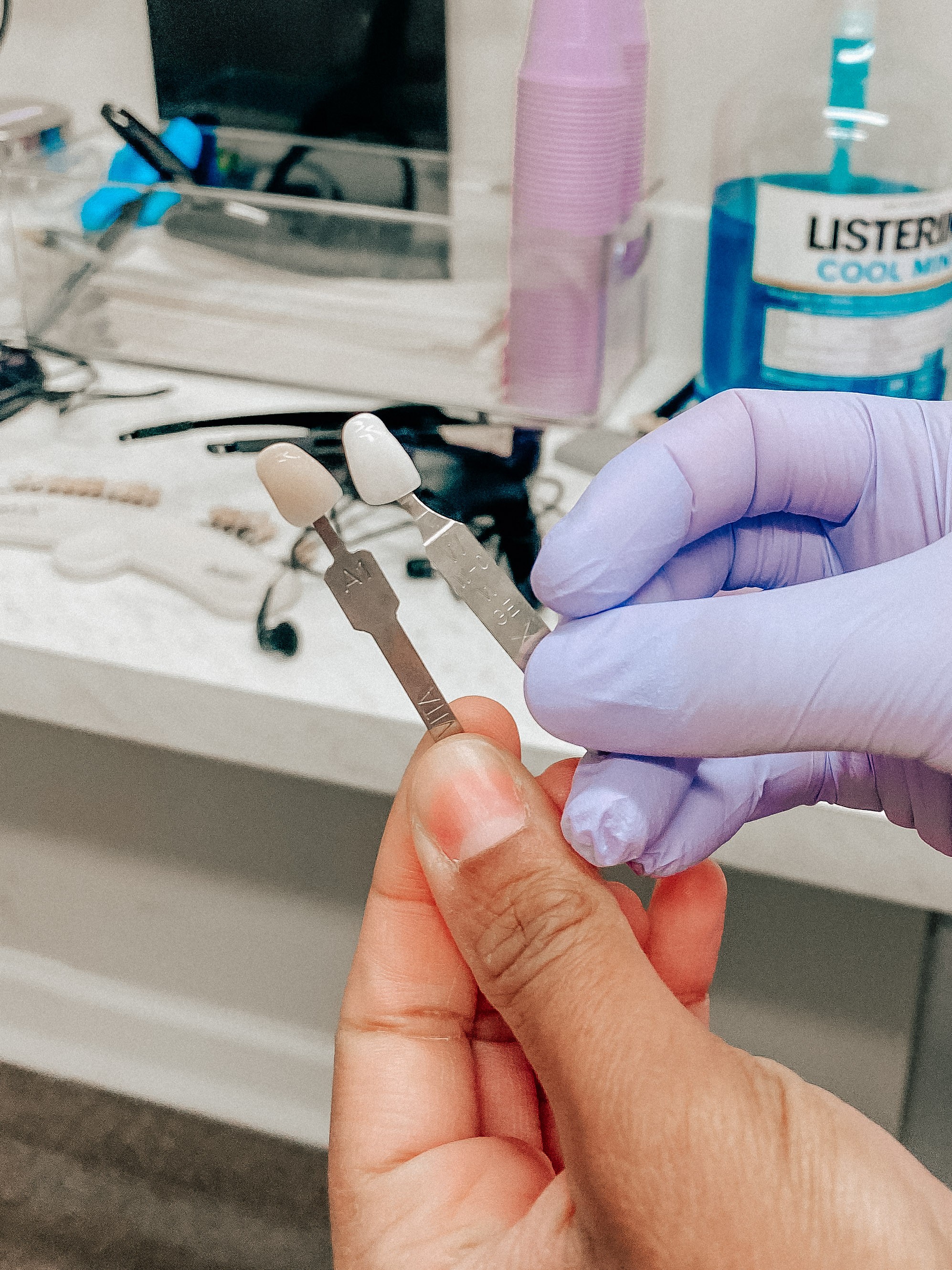 what you need to know about invisalign